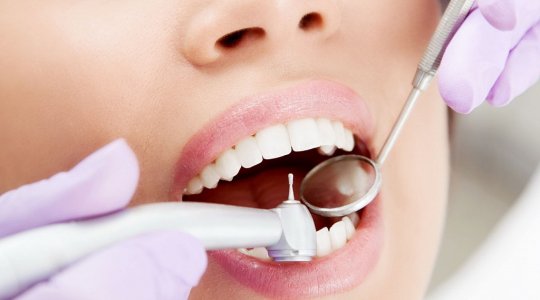 Кариес зубов - методы лечения